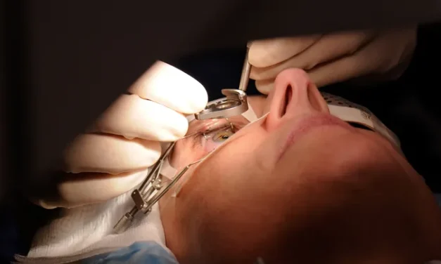 Fda Warns That Lasik Surgery Patients Need To Be Better Informed Of Risks Before Eye Procedure