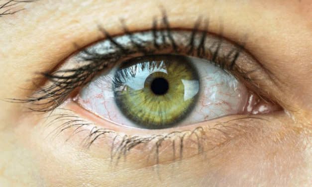Top 8 Causes Of Watery Eye