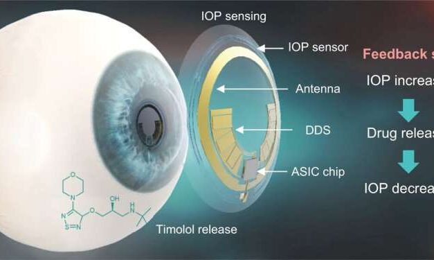 A Smart Contact Lens That Diagnoses And Treats Glaucoma
